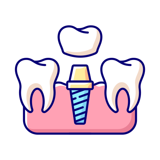 dental-implants