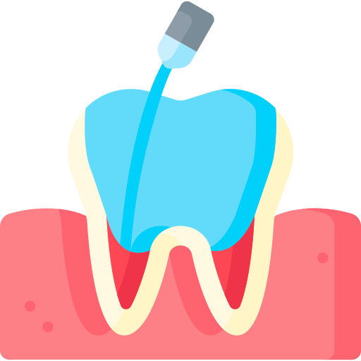 painless-root-canel